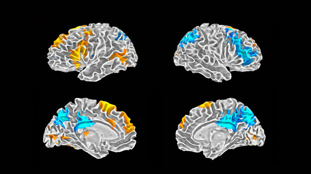 Rap Brain