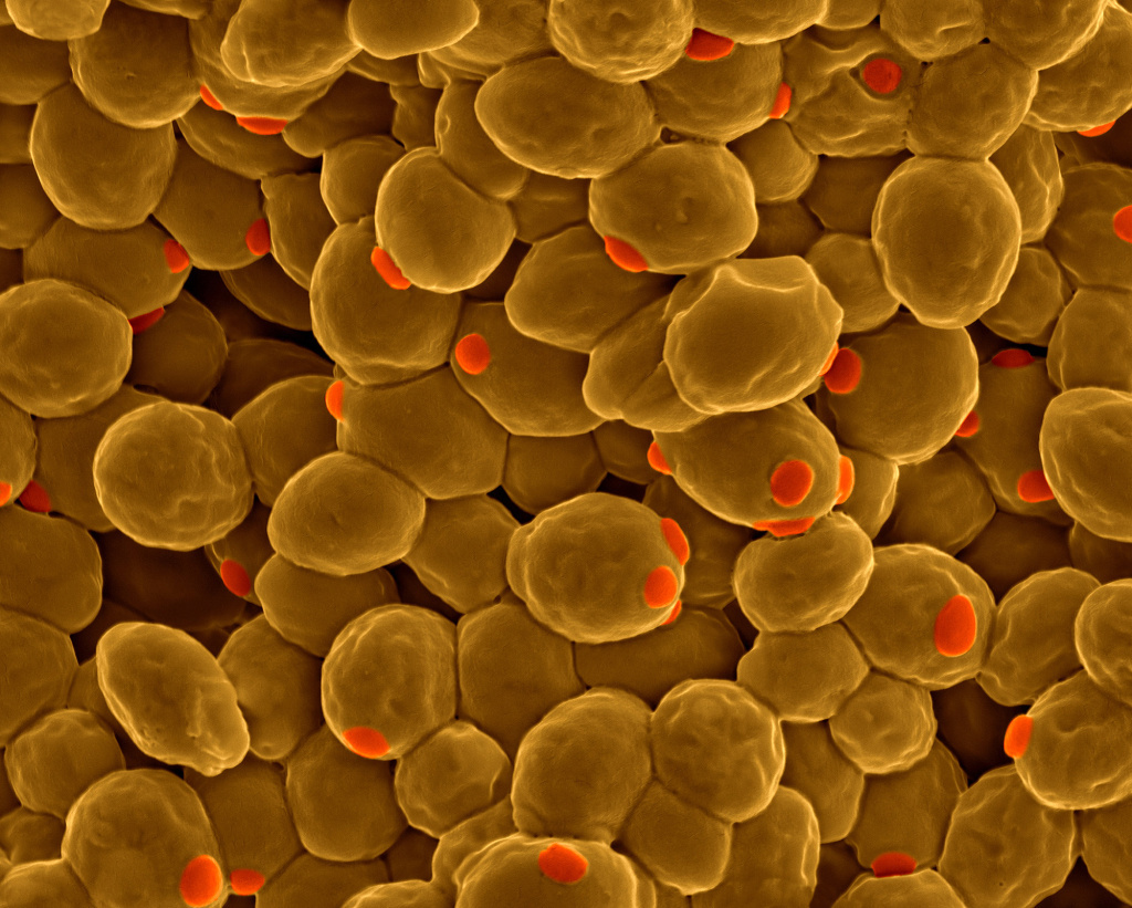 Colored scanning electron micrograph of baker's yeast, conventionally grown in the lab. So far, researchers have been able to synthesize six of the yeast's 16 chromosomes from scratch, and think they may be able to complete all 16 by 2018.