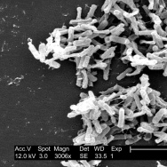 Clostridium difficile