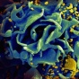 HIV particles, yellow, infect an immune cell, blue.