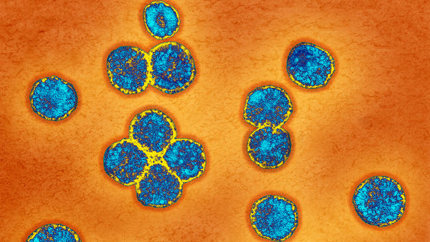 Coronaviruses can cause a mild cold or severe pneumonia-like symptoms.