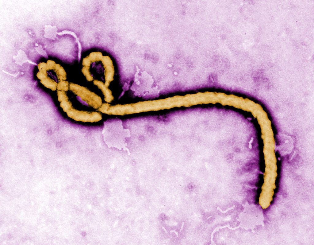 In this handout from the Center for Disease Control (CDC), a colorized transmission electron micrograph (TEM) of a Ebola virus virion is seen.