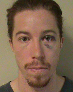 Shaun White booking photo after the extreme athlete was allegedly involved in some extreme drinking that led to vandalism charges.