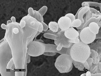 An image of the new Cryptococcus gattii fungus strain, magnified. Taken from the Center for Disease Control website on July 22, 2010.