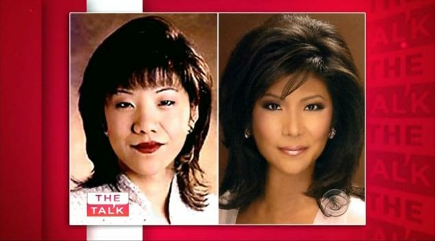 Julie Chen eye surgery