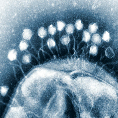 A tiny bacteriophage virus can cripple the bacteria that cause troublesome acne on teens' skin.