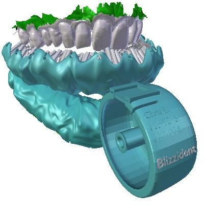 Blizzident 3-D printed toothbrush