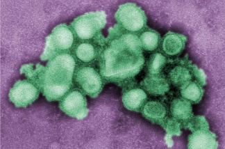 H1N1 virus