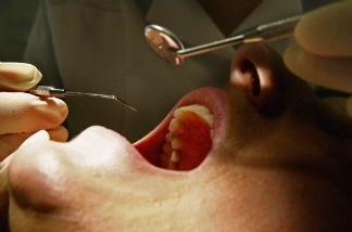 In South L.A., access to dental care among the safety-net population is "extremely limited," says one expert, and for many of those patients, dental health often isn't a "grade-A priority."