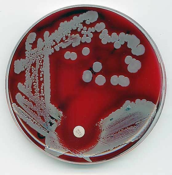 The bacteria behind staph infections.