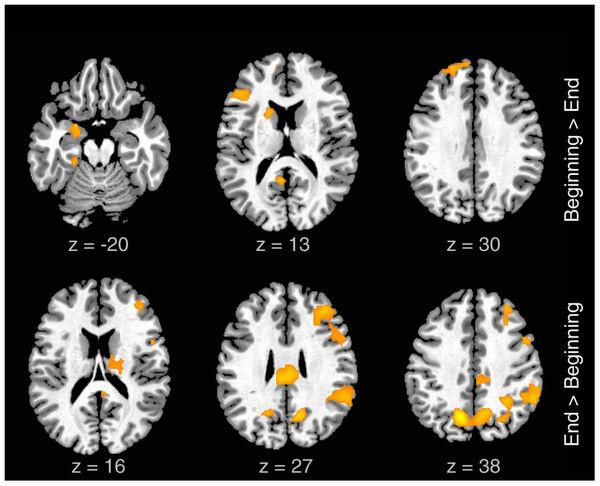Rap Brain