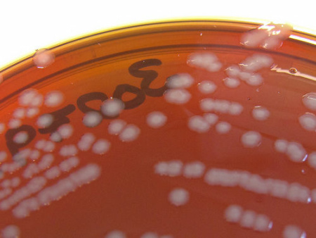 gonorrhea