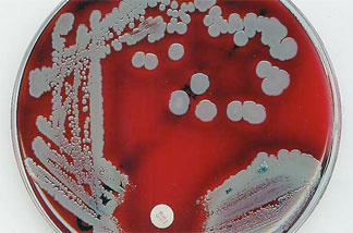 Staphylococcus aureus
