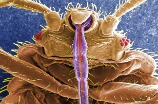 A bedbug, up close, shows off its skin-piercing mouth parts in purple.