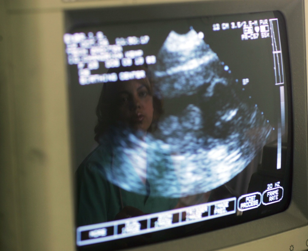 File: Zaditza Silveira is reflected in an ultrasound machine as she takes images of pregnant mothers at the Birthing Center of South Florida.