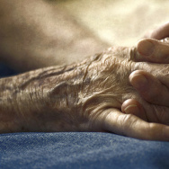 arthritis, hands