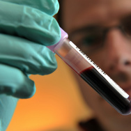 Blood Test