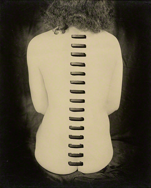 Stapled Flesh, 1949, Kansuke Yamamoto, gelatin silver print. From the collection of Gloria Katz and Willard Huyck. Marc Haefele writes, "Yamamoto seems to have disdained serenity for his entire working life and to always been involved in portraying the human psyche."