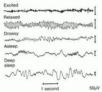 EEG Trace