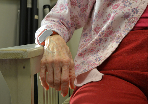 UCLA predicts that Alzheimer's disease will affect 1 in 85 people globally by 2050