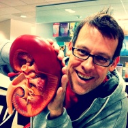 Kidney recipient James Rabe at Mayo Clinic, posing with a model kidney
