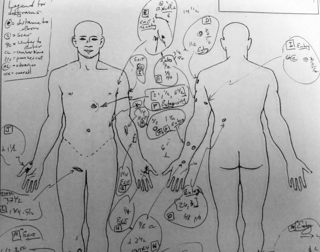 A drawing from Abdul Arian's autopsy shows multiple bullet wounds. Arian's family is suing LAPD, claiming they used excessive force when officers shot and killed the 19-year-old.