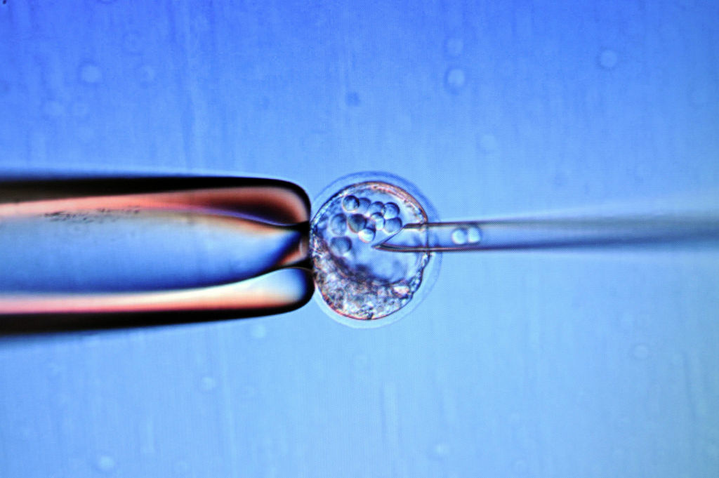 Close up of a screen which shows an inje Close up of a screen which shows an injection of embryo stem cells in a mouse to set a genetically modified line, on February 9, 2012 in Marseille, France.