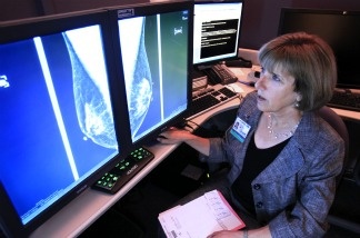 Dr. Karen Lindfors, a professor of radiology and chief of breast imaging at the UC Davis Medical Center, examines the mammogram of a patient with heterogeneously dense breast tissue. Lindfors opposes a measure approved by the state Legislature earlier this month, that would require health facilities performing mammograms to notify patients with dense tissue that they may want to receive additional screenings.
