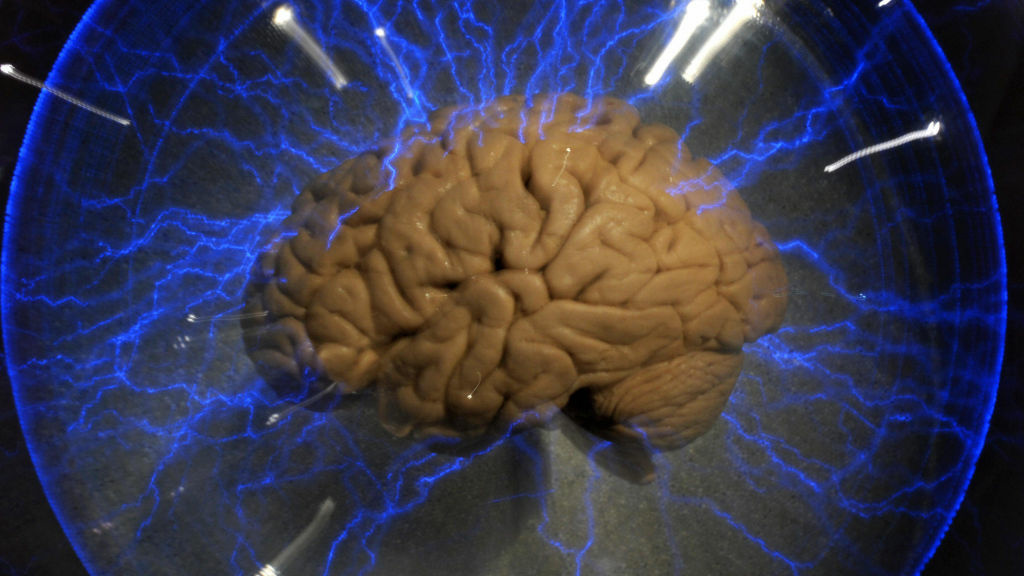 A human brain — part of a 2009 exhibition called The human brain.