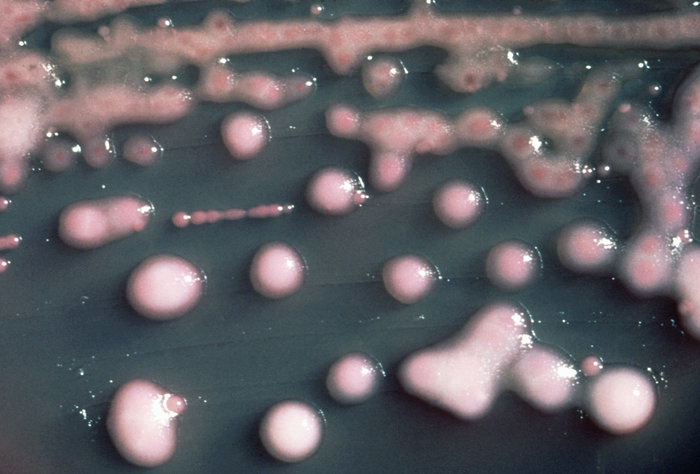 One form of carbapenem-resistant bacteria seen in culture. CRE bacteria are blamed for 600 deaths a year in the U.S. and can withstand treatment by virtually every kind of antibiotic. One form of carbapenem-resistant bacteria seen in culture. CRE bacteria are blamed for 600 deaths a year in the U.S. and can withstand treatment by virtually every kind of antibiotic.