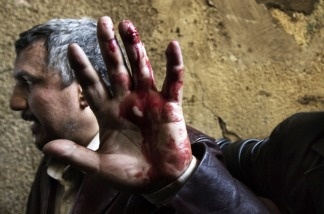 An Egyptian anti-regime protester, wounded during clashes with government supporters, gestures as he is taken into a makeshift clinic at the Ibad al-Rahman mosque near the flashpoint Tahrir square in Cairo on Feb. 2, 2011.