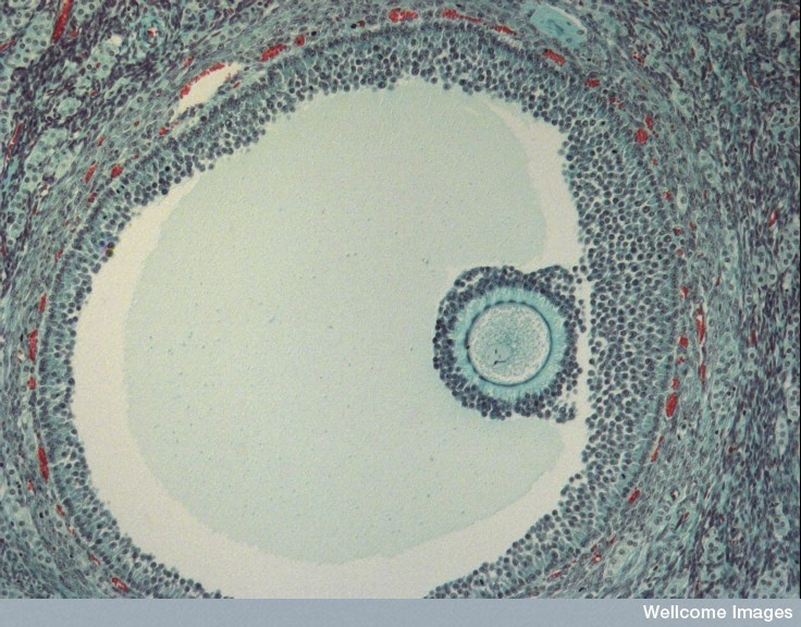 Egg Donation Human egg in a follicle.