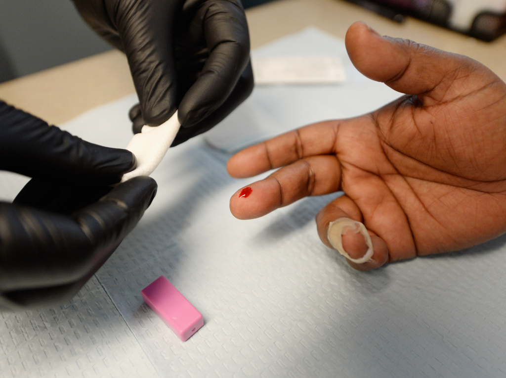 Health Fair In Los Angeles Offers Free Screenings For Residents A woman gets an instant HIV/AIDS test inside a moblile clinic of John Wesley Community Health Institute.