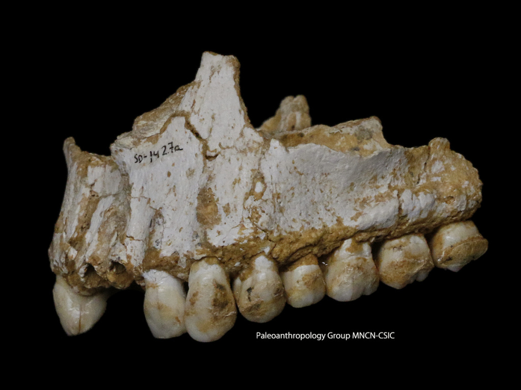 el-sidro-n-dental-calculus-sd-1427-paleoantropology-group-mncn-csic-c63e30987b628dd146f2ea5d164902e4f3b99d4c-s1200.jpeg A dental calculus deposit is visible on the rear molar (right). The teeth belong to the sick boy in the Spanish cave. He was eating poplar, a source of aspirin, and vegetation with mold, including the fungus Penicillium, which is the source of the antibiotic penicillin.