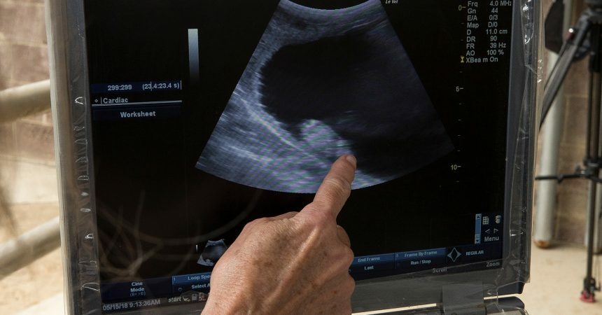 Officials at the San Diego Zoo released this ultrasound after announcing that own of their southern white rhinos has become pregnant through artificial insemination. Officials at the San Diego Zoo released this ultrasound after announcing that own of their southern white rhinos has become pregnant through artificial insemination.