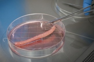 Scientists use a mesh material as a scaffold to seed bladder cells as they grow. After three to six weeks, the cells are transplanted inside the child's urethra, where they eventually replace the damaged tissue.