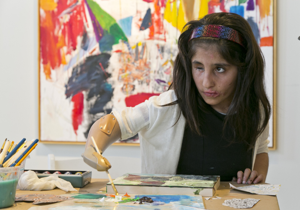 Afghan Girl-Prosthetic Artistry Afghan war victim Shah Bibi Tarakhail uses her new prosthetic arm to paint during a private session with artist Dayvd Whaley at Galerie Michael in Beverly Hills, Calif., Wednesday, April 2, 2014. Shah Bibi, a 7-year-old Afghani who lost her arm after picking up a grenade, received a new prosthetic arm at Shriners Hospital for Children and will be heading back home to her family on April 8, though she will return to Southern California in coming summers for additional medical procedures, including receiving a prosthetic eye.