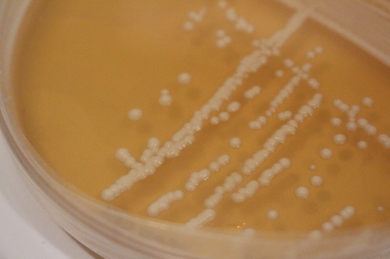Sour Beer Yeast Colonies of yeast that are capable of making sour beer grow in a Petri dish.