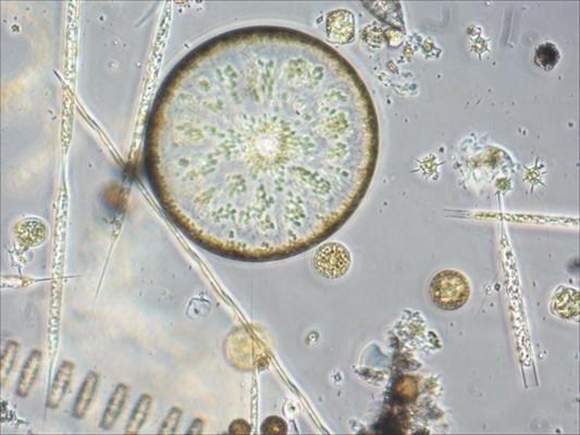 Phytoplankton An example of phytoplankton as photographed by researchers at the University of Southern California.