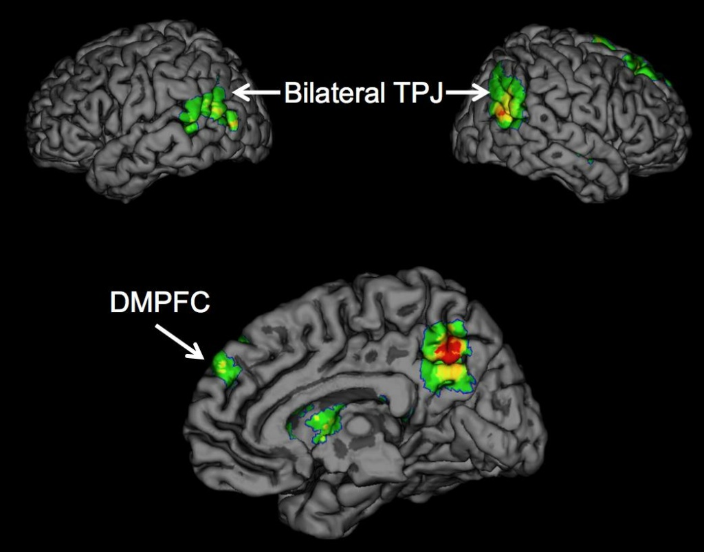 Brain Buzz UCLA Psychologists report for the first time that the temporoparietal junction (TPJ) and dorsomedial prefrontal cortex (DMPFC) brain regions are associated with the successful spread of ideas, often called 'buzz.'