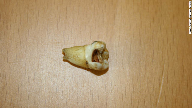 According to Omega Auction House, John Lennon's tooth is worth more than many cars.